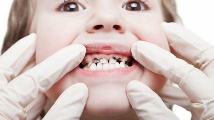 בצע את טיפול השיניים של ילדך במהלך הסמסטר!