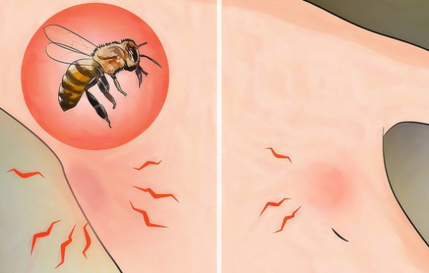 מהי אלרגיה לדבורים ומה הסימפטומים? שיטות טבעיות הטובות לעקיצות דבורים