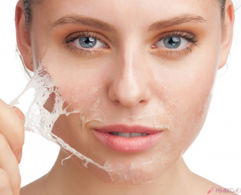 מה טוב לקילוף העור ואיך מתקלף העור? תרופה ביתית לקילוף עור