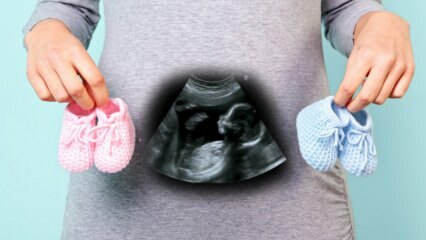 האם מגדר התינוק ייקבע בשליש הראשון להריון?