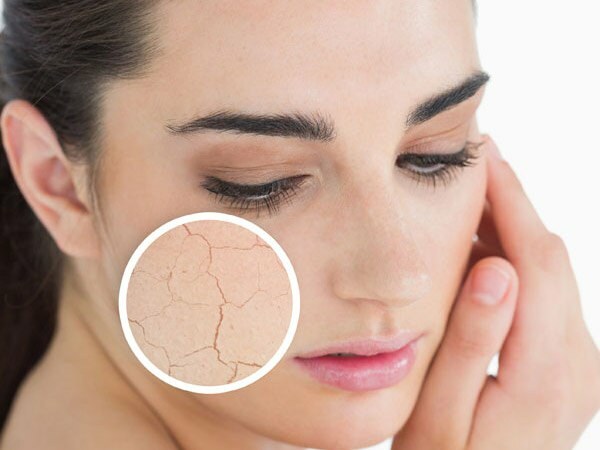 מדוע העור מתייבש? מה לעשות על עור יבש? המלצות הטיפול היעילות ביותר לעור יבש