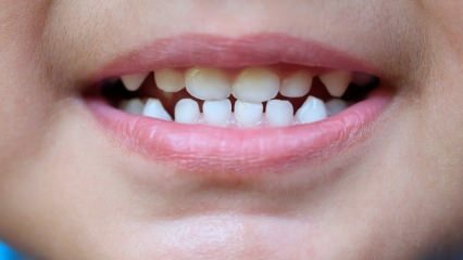 כיצד ללמד ילדים טיפול שיניים?