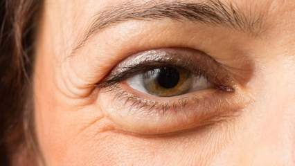 איך עוברים שקיות מתחת לעיניים? 10 הקרמים הטובים ביותר לשקיות מתחת לעיניים