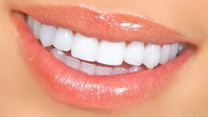 שיטות הלבנת שיניים טבעיות