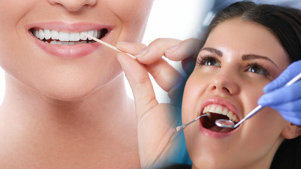 כיצד לשמור על בריאות הפה והשיניים? מה צריך לקחת בחשבון בעת ​​ניקוי שיניים?
