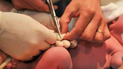 מתי חותכים את חבל הטבור אצל תינוקות? יתרונות חיתוך חבל הטבור באיחור