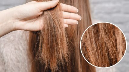 מה לעשות עם שיער שנשרף מאוריה? כיצד יש לטפל בשיער המטופל?