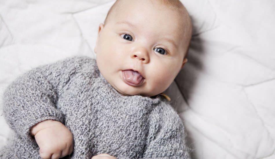 לשון בולטת אצל תינוקות