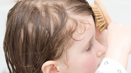 טיפול בשיער קשקשים בילדים