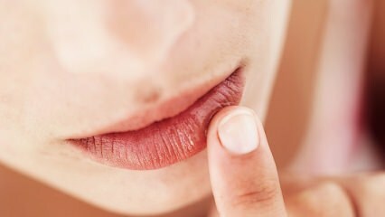 איך צריך להיות טיפול בשפתיים במהלך ההיריון?