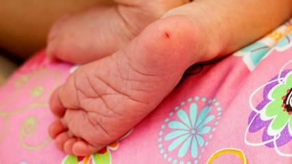מדוע נלקח דם בעקב בתינוקות? דרישות לבדיקת דם בעקב אצל תינוקות