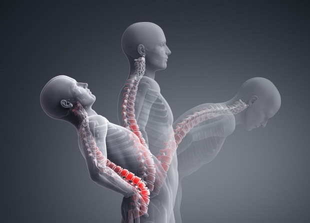 מהו שבר של התמוטטות עמוד השדרה? כיצד הטיפול בשבר בקריסת עמוד השדרה?