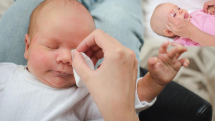 כיצד להסיר קוצים אצל תינוקות? גורם לצריבת עיניים אצל תינוקות? עיסוי בר עם חלב אם