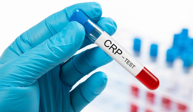 מדוע CRP בדם עולה? מה זה CRP? כיצד להוריד את ה- CRP?