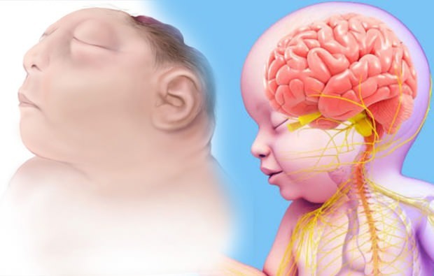 האם תינוק אננספללי חי? אבחון אננספללי