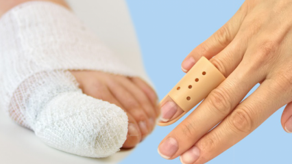 מה גורם לשבירת אצבעות? מהם התסמינים של שבירת אצבעות?
