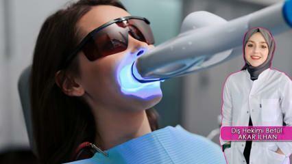 כיצד מתבצעת שיטת הלבנת שיניים (הלבנת)? האם שיטת ההלבנה פוגעת בשיניים?