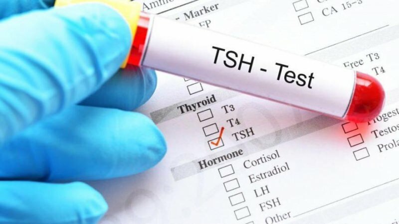 בדיקת tsh היא בדיקת הורמונים
