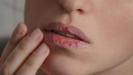 איך לטפל בשפתיים בבית? טיפוח שפתיים יבש קל בן 4 שלבים