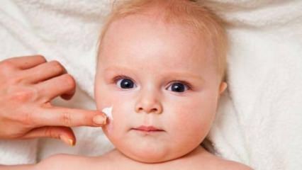 טיפים לטיפול בעור לתינוקות! מהן בעיות העור אצל תינוקות?