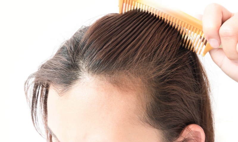 פתרונות נשירת שיער לאחר הלידה! מה טוב לנשירת שיער?