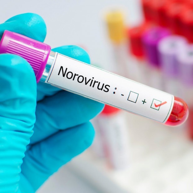 מה זה נורובירוס ואילו מחלות הוא גורם? לא ידוע לגבי זיהום Norovirus ...