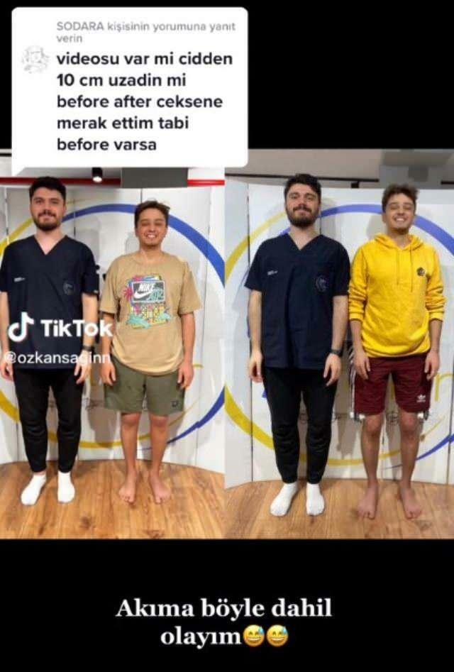 Özkan Sağın עשה לפני ואחרי הניתוח