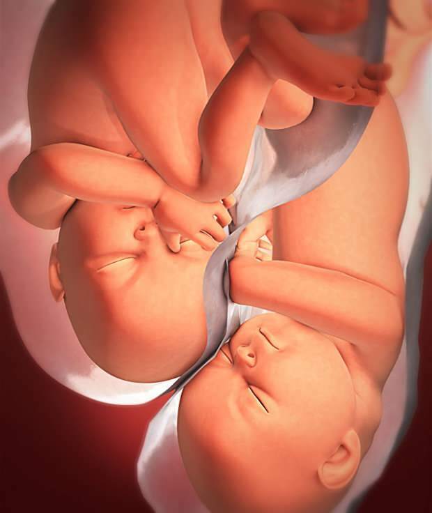 מהם הסימפטומים של הריון תאומים?