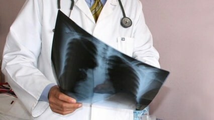 מומחים הודיעו! עלייה בתמותה מסרטן הריאות