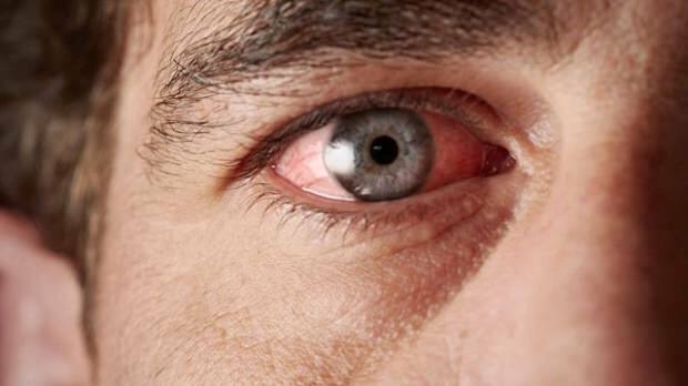 נזקים שנגרמו על ידי משקפי שמש מזויפים? תוצאות המובילות לעיוורון ...