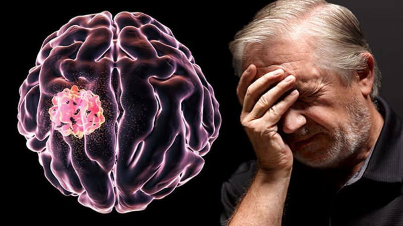 הרקמה שנוצרת במוח על ידי שיבוש מבני התאים נקראת גידול.