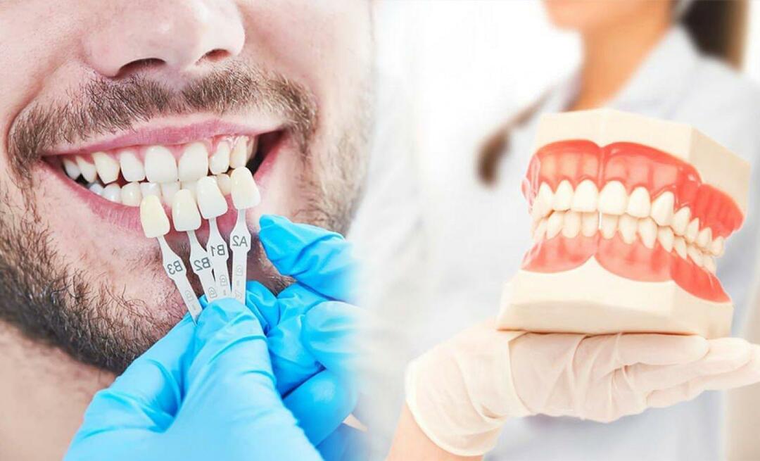 מדוע מורחים ציפוי זירקוניום על השיניים? כמה עמיד ציפוי הזירקוניום?