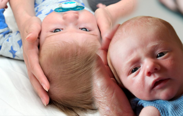 איך צריכה להיות צורת הראש אצל תינוקות?