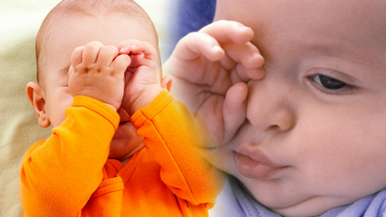 פתרונות טבעיים לשריפת עיניים אצל תינוקות