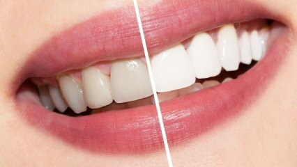 מהן ההמלצות לשיניים לבנות? מרפא הלבנת שיניים באופן טבעי בבית ...