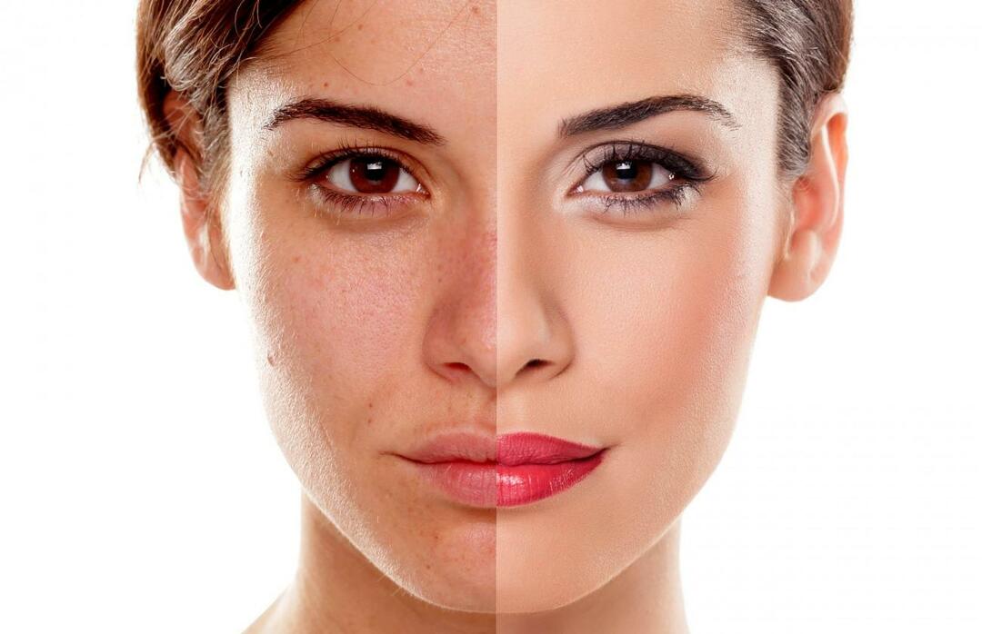 איך מונעים מהעור להיראות עייף? איך להפחית את המראה העייף של העור?