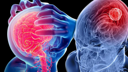 מהי ניוון של המוח הקטן (עמוד השדרה)? מהם התסמינים של המוח הקטן (חוט השדרה)?