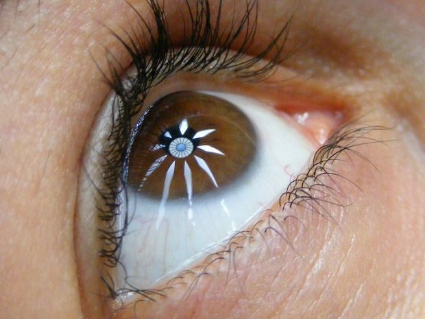 מהי מחלת עיוורון לילה (עוף שחור)? מהם הסימפטומים של עיוורון לילה?