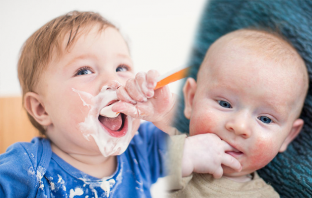 תסמיני אלרגיה למזון אצל תינוקות