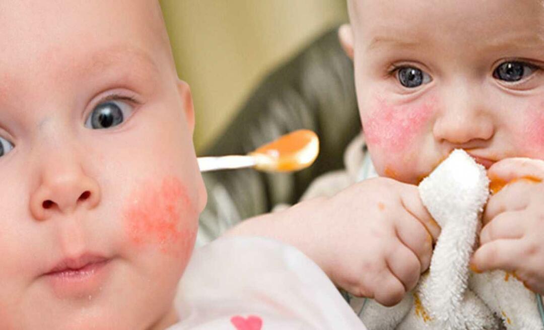 מה תינוק עם אלרגיה צריך לאכול? מהם מזונות אלטרנטיביים לתינוקות אלרגיים?