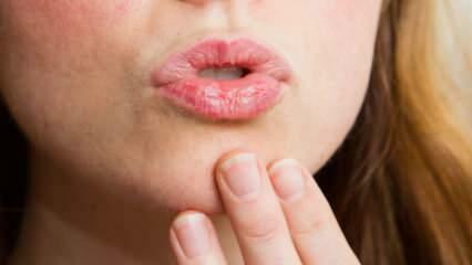 איך לעשות טיפוח שפתיים בבית? טיפוח שפתיים יבשות קל ב-4 שלבים