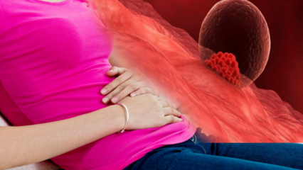 מהו דימום השתלות במהלך ההריון? כיצד להבחין בין דימום השתלות לדימום וסת