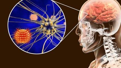 מהי דלקת קרום המוח ומהם התסמינים שלה? האם יש טיפול לדלקת קרום המוח?