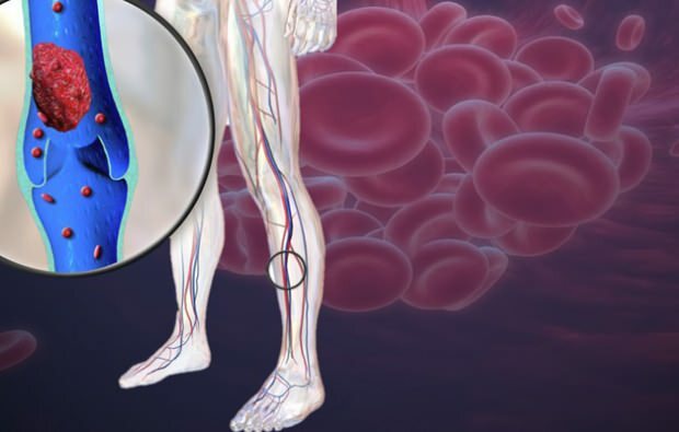 ירידה במחזור הדם בעורקי הרגליים גורמת לכאב